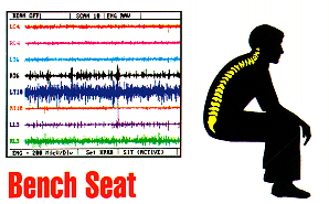 Grafik: EMG-Aktivitt bei schlechter Sitzhaltung